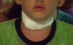 Line with wax hurts seven year-old boy’s neck in&nbsp;Sydney